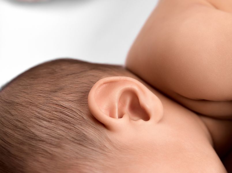 Babyacne: vragen & antwoorden