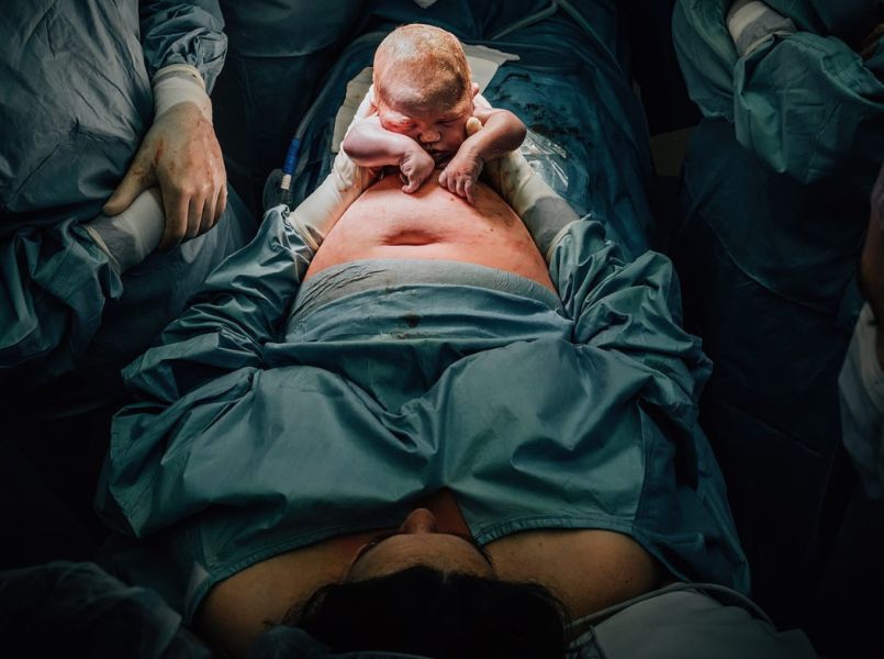 De moedergeassisteerde keizersnede: dit online magazine geeft alle informatie