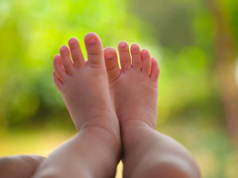 Syndactylie: wat is het precies?