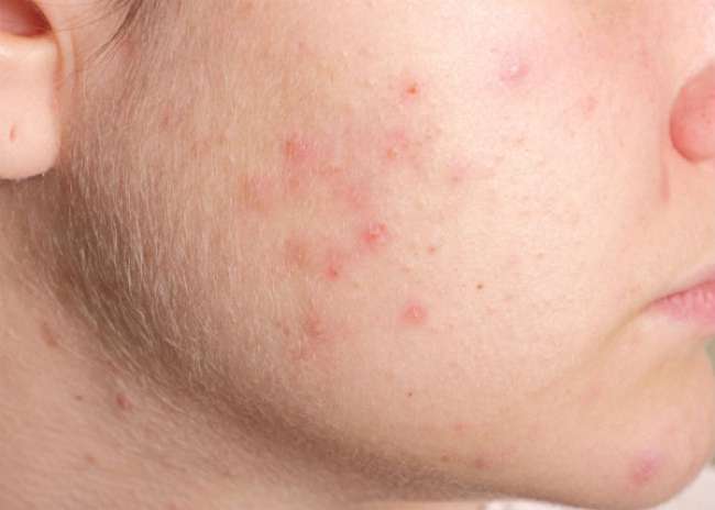 6 niet zo charmante lichamelijke zwangerschapsverrassingen