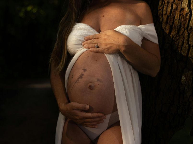 Een navelbreuk tijdens je zwangerschap: vragen & antwoorden