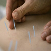 Acupunctuur en zwangerschap 