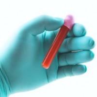 Tests Tijdens De Zwangerschap Hemoglobinegehalte