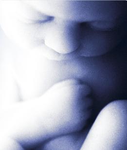 hasmenés 37 weken zwanger az uvula pikkelyes papillómája